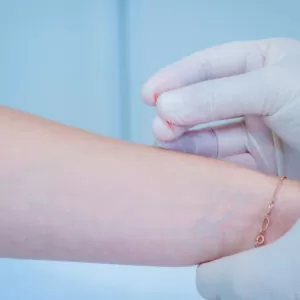 Иглорефлексотерапия в санатории 'Русь' в г. Ессентуки - фотография